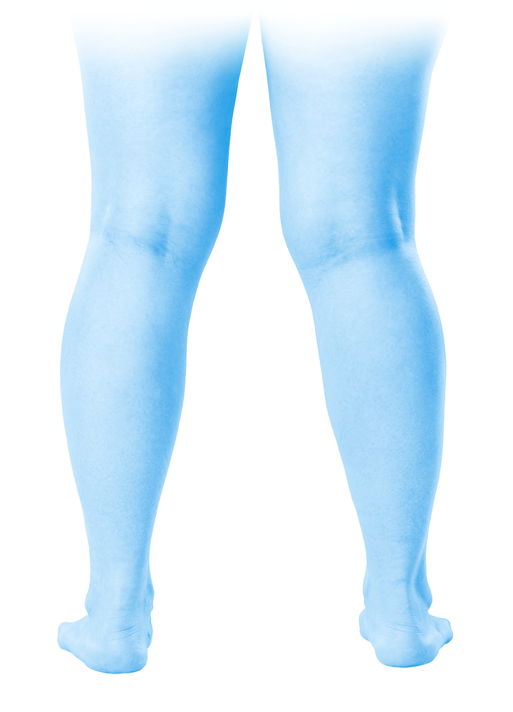 Chirurgie esthétique des genoux par le Docteur Weiss du CCEPO