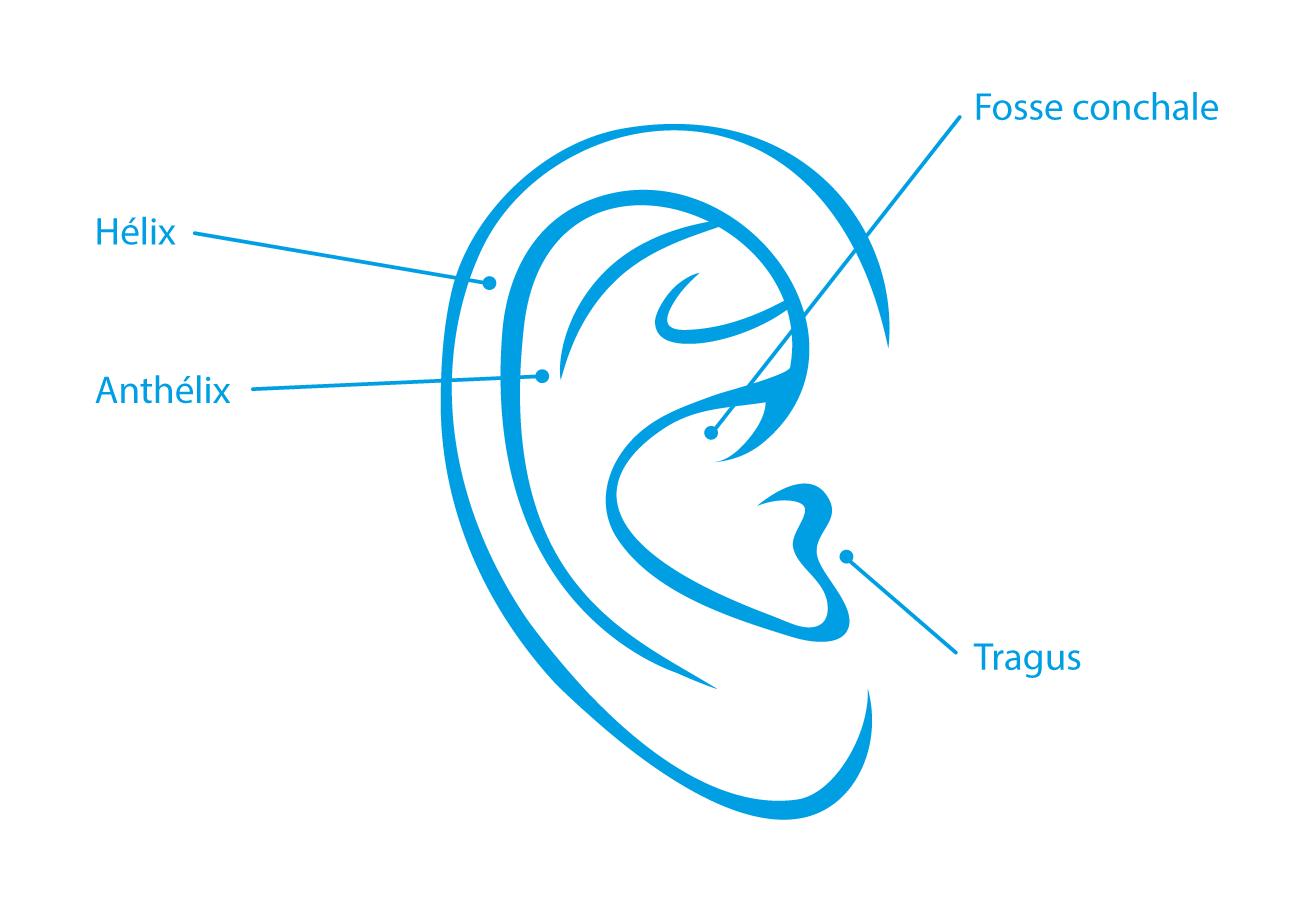 Chirurgie oreilles par le Docteur Weiss du CCEPO