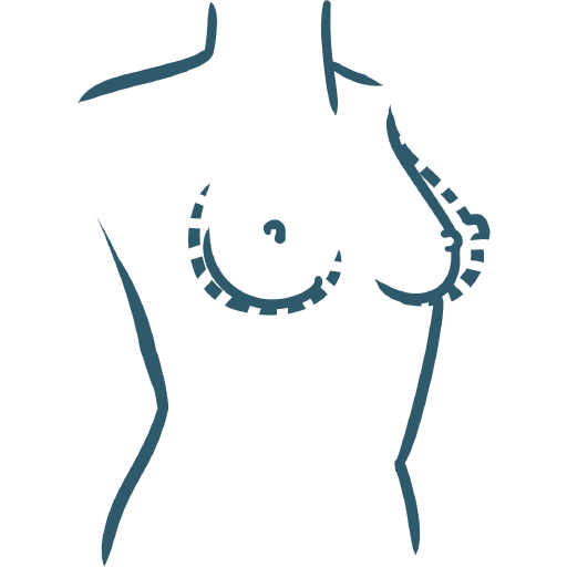 Chirurgie esthétique des seins : réduction mammaire par le Docteur Weiss du CCEPO à Paris