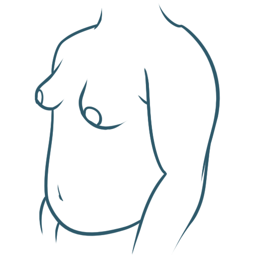 Chirurgie esthétique des seins : gynécomastie par le Docteur Weiss du CCEPO à Paris