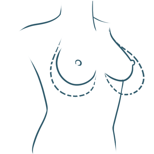 Chirurgie esthétique des seins : remodelage mammaire par le Docteur Weiss du CCEPO à Paris